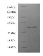 Human Parathyroid hormone 2 receptor (PTH2R), partial Recombinant Protein - BioCrest Sci
