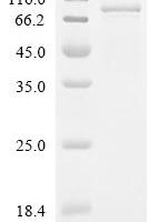 Human Cadherin-15 (CDH15), partial Recombinant Protein - BioCrest Sci