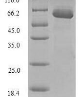 Human Sulfotransferase 1A1 (SULT1A1) Recombinant Protein - BioCrest Sci