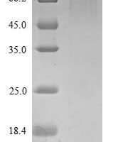 Mouse Roundabout homolog 1 (Robo1), partial Recombinant Protein, N-His - BioCrest Sci