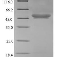 Escherichia coli O157:H7 Protease 7 (ompT) Recombinant Protein - BioCrest Sci