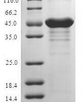 Human Retinoschisin (RS1) Recombinant Protein, N-GST - BioCrest Sci