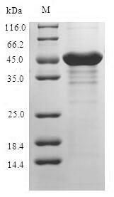 Human Retinoschisin (RS1) Recombinant Protein, N-GST, Homo sapiens (Human), E.coli, N-terminal GST-tagged, 50.0 kDa, purity >≥ 90% as determined by SDS-PAGE.
