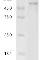 Geobacillus stearothermophilus Neopullulanase (nplT), partial Recombinant Protein - BioCrest Sci