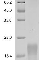 Macaca mulatta TNF receptor superfamily member 13C (TNFRSF13C), partial Recombinant Protein - BioCrest Sci