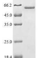 Mouse Transcription factor GATA-4 (GATA4) Recombinant Protein - BioCrest Sci