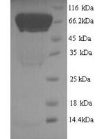Human Autophagy-related protein 16-1 (ATG16L1) Recombinant Protein, N-His - BioCrest Sci