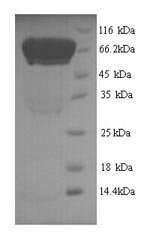 Human Autophagy-related protein 16-1 (ATG16L1) Recombinant Protein, N-His, Homo sapiens (Human), Yeast, N-terminal 6xHis-tagged, 70.3 kDa, purity >≥ 90% as determined by SDS-PAGE.