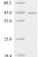 Human Auxilin (DNAJC6), partial Recombinant Protein - BioCrest Sci