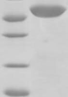 Human Glucocorticoid receptor (NR3C1), partial Recombinant Protein, N-His-Trx - BioCrest Sci