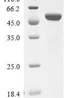 Escherichia coli Tyrosine--tRNA ligase (tyrS) Recombinant Protein - BioCrest Sci