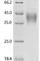 Mouse Natural cytotoxicity triggering receptor 1 (Ncr1), partial Recombinant Protein - BioCrest Sci