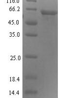 Human Proteasomal ubiquitin receptor ADRM1 (ADRM1) Recombinant Protein - BioCrest Sci