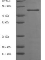 Aspergillus niger Probable alpha-galactosidase B (aglB) Recombinant Protein - BioCrest Sci