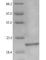Escherichia coli Elongation factor P (efp) Recombinant Protein, N-His, Full-Length - BioCrest Sci
