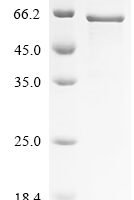 Human MAP kinase-interacting serine/threonine-protein kinase 1 (MKNK1) Recombinant Protein - BioCrest Sci