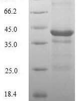 Human Histone H2A.Z (H2AZ1) Recombinant Protein - BioCrest Sci