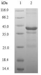 Human Histone H2A.Z (H2AZ1) Recombinant Protein, Homo sapiens (Human), E.coli, N-terminal GST-tagged, 40.2 kDa, purity >≥ 90% as determined by SDS-PAGE.