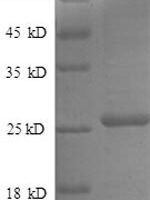 Human Metalloproteinase inhibitor 4 (TIMP4), partial Recombinant Protein - BioCrest Sci