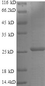 Human Metalloproteinase inhibitor 4 (TIMP4), partial Recombinant Protein, Homo sapiens (Human), E.coli, N-terminal 6xHis-tagged, 26.3 kDa, purity >≥ 90% as determined by SDS-PAGE.