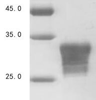 Human Orexin/Hypocretin receptor type 1 (HCRTR1), partial Recombinant Protein, N-His-SUMOstar - BioCrest Sci