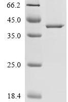 Human D-beta-hydroxybutyrate dehydrogenase, mitochondrial (BDH1) Recombinant Protein, C-His - BioCrest Sci