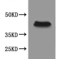 Xenopus laevis Progestin and adipoQ receptor family member VIII L homeolog (paqr8.L)-VLPs Recombinant Protein - BioCrest Sci