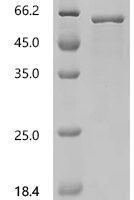 Human Histidine decarboxylase (HDC), partial Recombinant Protein, C-His, aa 2–477, E.coli - BioCrest Sci