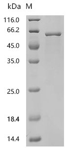Human Histidine decarboxylase (HDC), partial Recombinant Protein, C-His, aa 2–477, E.coli, Homo sapiens (Human), E.coli, C-terminal 6xHis-tagged, 60.8 kDa, purity >≥ 95% as determined by SDS-PAGE.