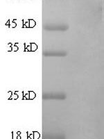 Rat Vitamin K-dependent protein S (Pros1) Recombinant Protein, N-His - BioCrest Sci