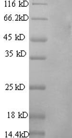 Rat Vitamin K-dependent protein S (Pros1) Recombinant Protein, N-His, Rattus norvegicus (Rat), Mammalian cell, N-terminal 6xHis-tagged, 73.9 kDa, purity >≥ 90% as determined by SDS-PAGE.