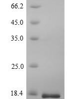Human Voltage-dependent calcium channel subunit alpha-2/delta-1 (CACNA2D1), partial Recombinant Protein - BioCrest Sci