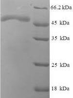 Escherichia coli Phosphoserine phosphatase (serB) Recombinant Protein - BioCrest Sci