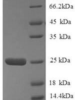 Human HLA class II histocompatibility antigen, DQ alpha 2 chain (HLA-DQA2), partial Recombinant Protein - BioCrest Sci
