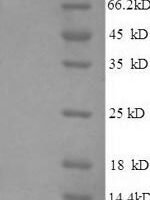Human Pulmonary surfactant-associated protein C (SFTPC) Recombinant Protein, N-His, aa 24–58, Mammalian cell - BioCrest Sci