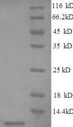 Human Pulmonary surfactant-associated protein C (SFTPC) Recombinant Protein, N-His, aa 24–58, Mammalian cell, Homo sapiens (Human), Mammalian cell, N-terminal 6xHis-tagged, 7.7 kDa, purity >≥ 90% as determined by SDS-PAGE.