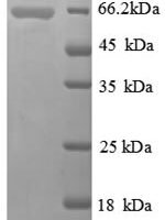 Thermus aquaticus DNA polymerase I, thermostable (polA), partial Recombinant Protein, N-His, aa 289–832, E.coli - BioCrest Sci