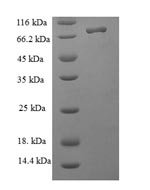Human Nucleolar protein 58 (NOP58) Recombinant Protein - BioCrest Sci
