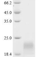 Human Vigilin (HDLBP), partial Recombinant Protein - BioCrest Sci