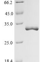 Human Caspase-3 (CASP3),Partial Recombinant Protein - BioCrest Sci