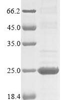 Akkermansia muciniphila Crossover junction endodeoxyribonuclease RuvC (ruvC) Recombinant Protein - BioCrest Sci