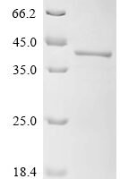 Mouse Tumor necrosis factor receptor type 1-associated DEATH domain protein(Tradd) Recombinant Protein - BioCrest Sci