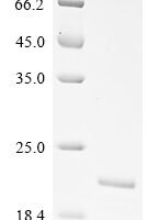 Vaccinia virus 14 kDa fusion protein (A27L) Recombinant Protein, N-His - BioCrest Sci