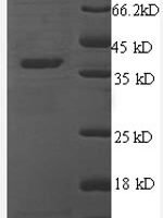Human Thrombospondin-1 (THBS1), partial Recombinant Protein - BioCrest Sci