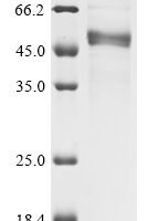 Cat Interleukin-1 (IL1RN) Recombinant Protein - BioCrest Sci