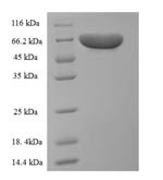 Rat Pyruvate kinase isozymes R/L (Pklr) Recombinant Protein - BioCrest Sci