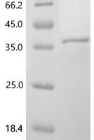 Mouse Trace amine-associated receptor 1 (Taar1), partial Recombinant Protein - BioCrest Sci