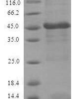 Zaire ebolavirus Transcriptional activator VP30 (VP30) Recombinant Protein, N-His-SUMO - BioCrest Sci