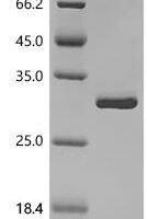 Human Myocilin (MYOC), partial Recombinant Protein, N-10His - BioCrest Sci