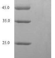 Arabidopsis thaliana Acetolactate synthase, chloroplastic (ALS), partial Recombinant Protein, N-His - BioCrest Sci